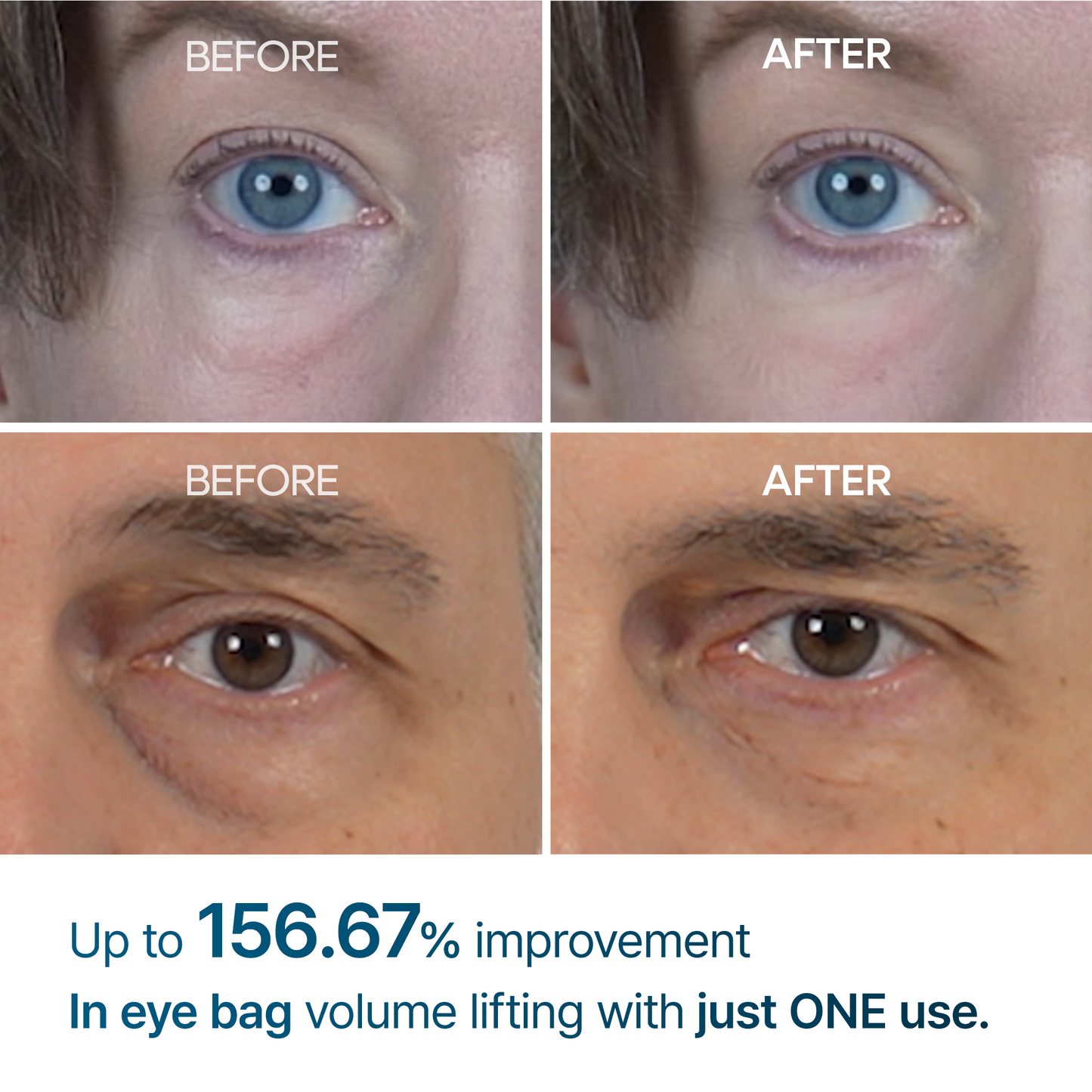 [SPECIAL 1+1 DEAL] Eyephalt eyebag cream